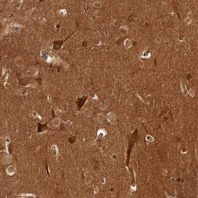 Immunohistochemistry-Paraffin: CAMSAP1L1 Antibody [NBP1-82935]