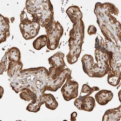 Immunohistochemistry-Paraffin: CAMSAP1L1 Antibody [NBP1-82935]