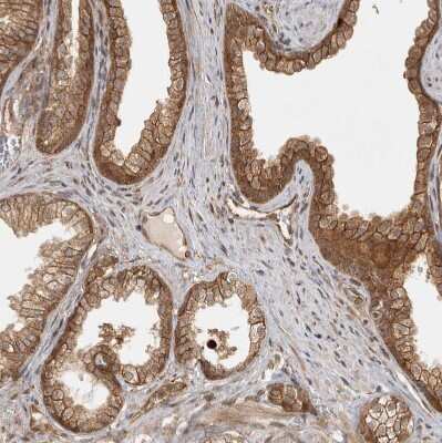 Immunohistochemistry-Paraffin: CAMSAP1L1 Antibody [NBP1-82935]