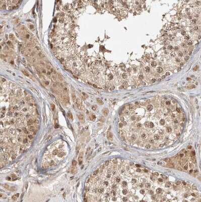 Immunohistochemistry-Paraffin: CAMSAP1L1 Antibody [NBP1-82935]