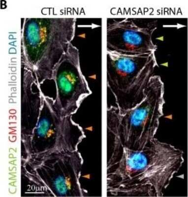 Knockdown Validated: CAMSAP1L1 Antibody [NBP1-21402]