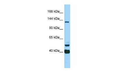 Western Blot: CAMSAP3 Antibody [NBP2-84587]