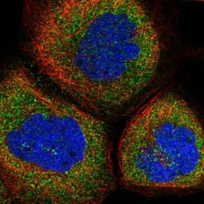 Immunocytochemistry/ Immunofluorescence: CAMTA1 Antibody [NBP1-93620]