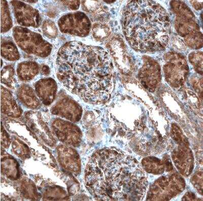 Immunohistochemistry-Paraffin: CAMTA1 Antibody [NBP1-93620]