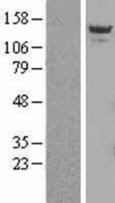 Western Blot: CAMTA2 Overexpression Lysate [NBL1-08671]