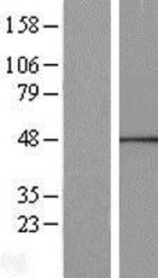 Western Blot: Calcium Activated Nucleotidase 1/CANT1 Overexpression Lysate [NBL1-08672]