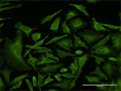 Immunocytochemistry/ Immunofluorescence: CAP1 Antibody (4A9) [H00010487-M02]