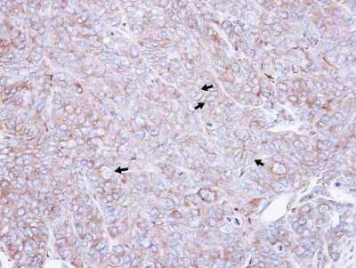 Immunohistochemistry-Paraffin: CAP1 Antibody [NBP1-31718]