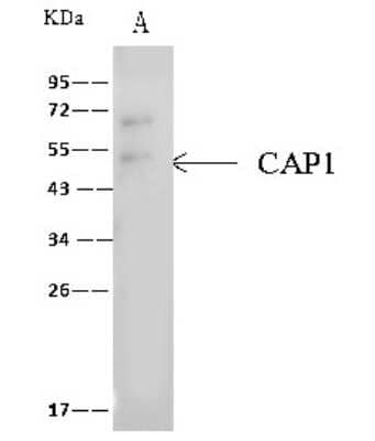 Immunoprecipitation: CAP1 Antibody [NBP2-99569]