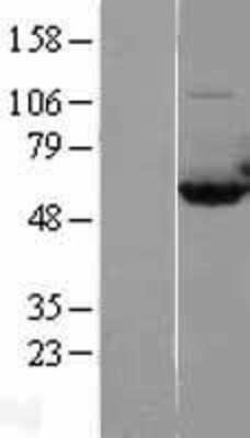 Western Blot: CAP1 Overexpression Lysate [NBL1-08674]