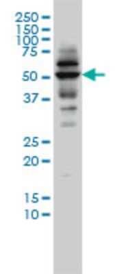 Western Blot: CAP2 Antibody (3G9-1A5) [H00010486-M01]