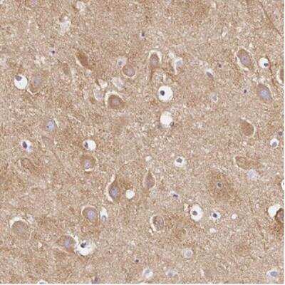 Immunohistochemistry: CAP2 Antibody [NBP2-30561]