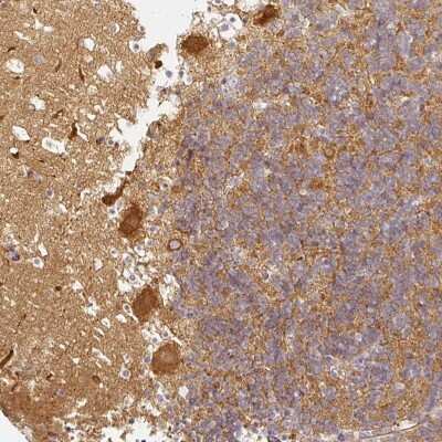 Immunohistochemistry: CAP2 Antibody [NBP2-30572]