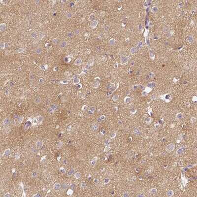 Immunohistochemistry-Paraffin: CAP2 Antibody [NBP2-30561]