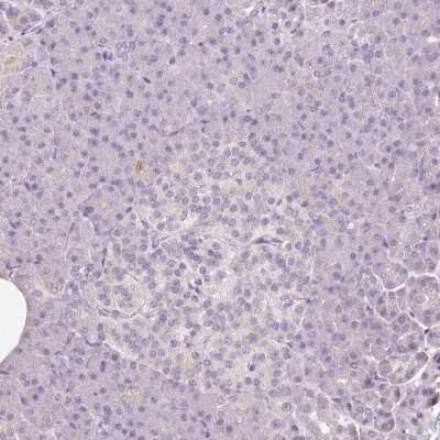 Immunohistochemistry-Paraffin: CAP2 Antibody [NBP2-30561]