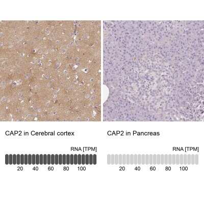 Immunohistochemistry-Paraffin: CAP2 Antibody [NBP2-30561]