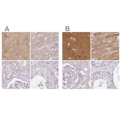 Immunohistochemistry-Paraffin: CAP2 Antibody [NBP2-30561]