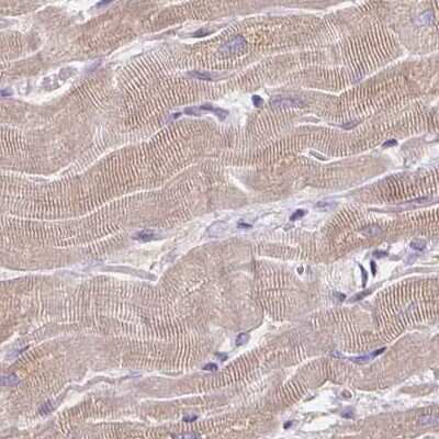 Immunohistochemistry-Paraffin: CAP2 Antibody [NBP2-30561]