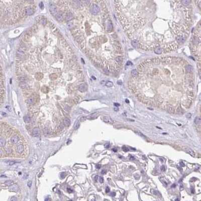 Immunohistochemistry-Paraffin: CAP2 Antibody [NBP2-30561]