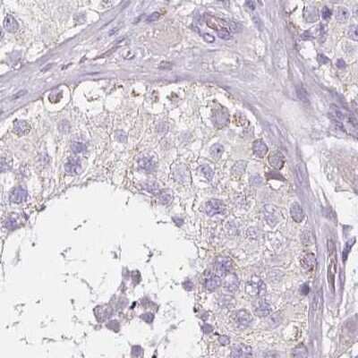Immunohistochemistry-Paraffin: CAP2 Antibody [NBP2-30561]