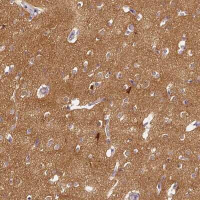 Immunohistochemistry-Paraffin: CAP2 Antibody [NBP2-30572]