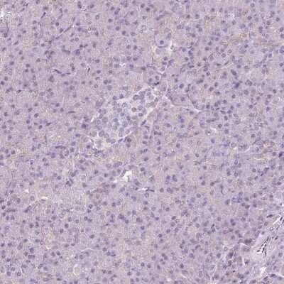 Immunohistochemistry-Paraffin: CAP2 Antibody [NBP2-30572]