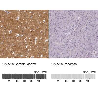 Immunohistochemistry-Paraffin: CAP2 Antibody [NBP2-30572]