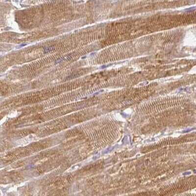 Immunohistochemistry-Paraffin: CAP2 Antibody [NBP2-30572]