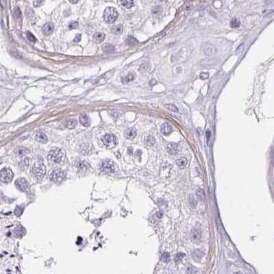 Immunohistochemistry-Paraffin: CAP2 Antibody [NBP2-30572]