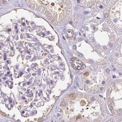 Immunohistochemistry-Paraffin: CAP2 Antibody [NBP2-30572]
