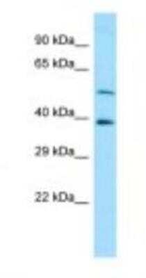 Western Blot: CAP2 Antibody [NBP1-98541]