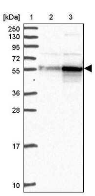 Western Blot: CAP2 Antibody [NBP2-30572]