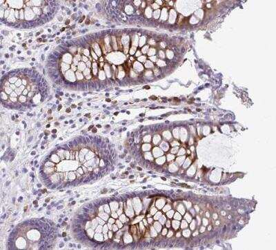 Immunohistochemistry-Paraffin: CAPC / LRRC26 Antibody [NBP2-30877]