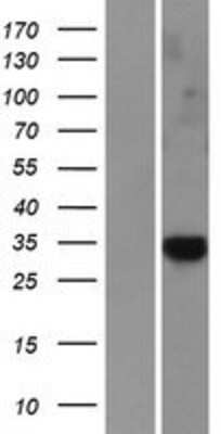 Western Blot: CAPC / LRRC26 Overexpression Lysate [NBP2-11010]