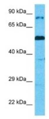 Western Blot: CAPN14 Antibody [NBP3-10664]