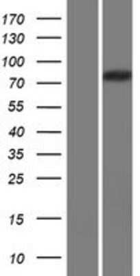 Western Blot: CAPN14 Overexpression Lysate [NBP2-09728]