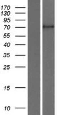 Western Blot: Calpain 5 Overexpression Lysate [NBP2-07918]