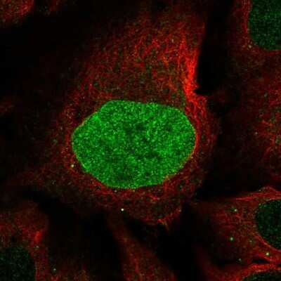 Immunocytochemistry/ Immunofluorescence: CAPN8 Antibody [NBP2-56622]