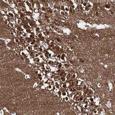 Immunohistochemistry-Paraffin: CAPRIN2 Antibody [NBP1-88318]