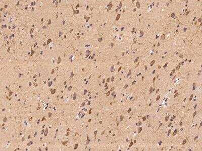 Immunohistochemistry-Paraffin: CAPRIN2 Antibody [NBP3-06021]