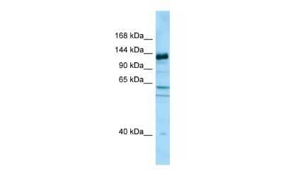 Western Blot: CAPRIN2 Antibody [NBP2-82980]