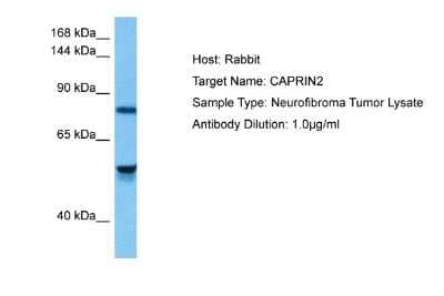 Western Blot: CAPRIN2 Antibody [NBP2-82988]