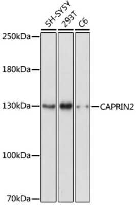 Western Blot: CAPRIN2 AntibodyAzide and BSA Free [NBP3-05200]