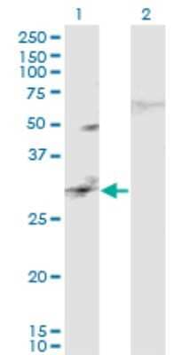 Western Blot: CAPS2 Antibody (3C6) [H00084698-M02]