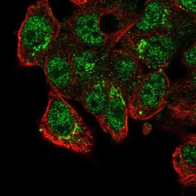 Immunocytochemistry/ Immunofluorescence: CADPS2 Antibody [NBP2-58206]