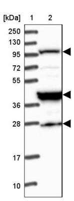 Western Blot: CAPS2 Antibody [NBP1-85855]