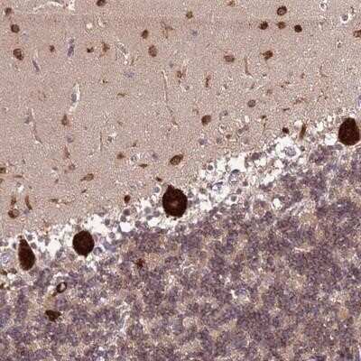 Immunohistochemistry-Paraffin: CAPSL Antibody [NBP2-14437]