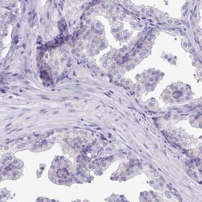 Immunohistochemistry-Paraffin: CAPSL Antibody [NBP2-14437]