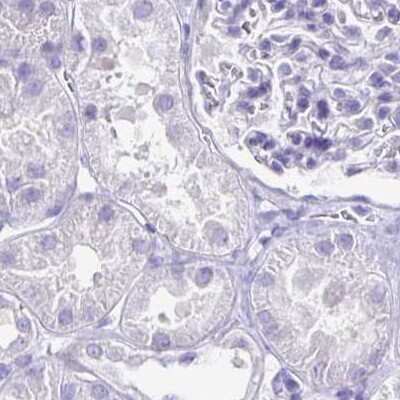 Immunohistochemistry-Paraffin: CAPSL Antibody [NBP2-14437]