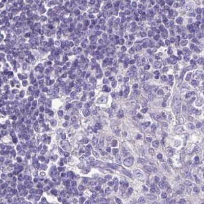 Immunohistochemistry-Paraffin: CAPSL Antibody [NBP2-14437]